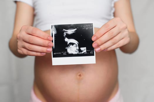 photo of a pregnant ultrasound in the hands of a pregnant girl on the background of the abdomen