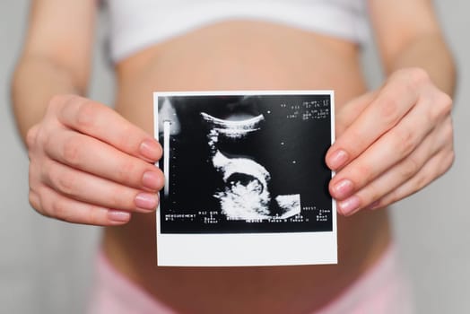 photo ultrasound in the hands of a pregnant young girl on a belly background