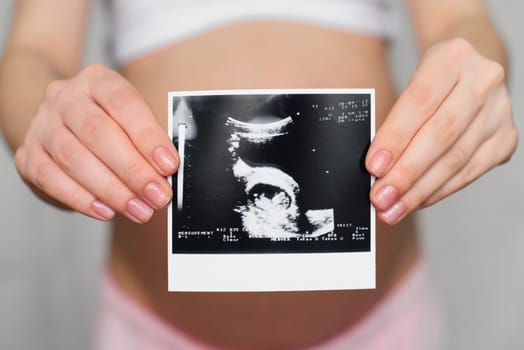 ultrasound picture in the hands of a pregnant girl on the background of the abdomen