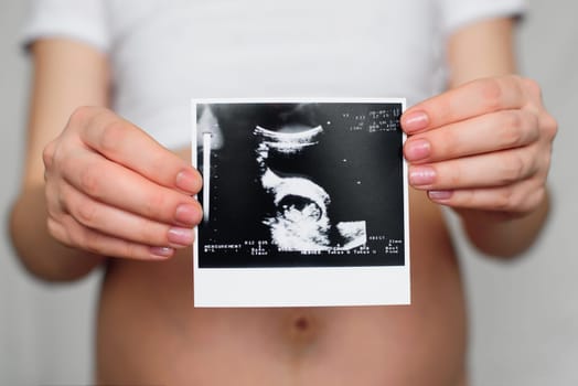 ultrasound picture in the hands of a pregnant girl on the background of the abdomen