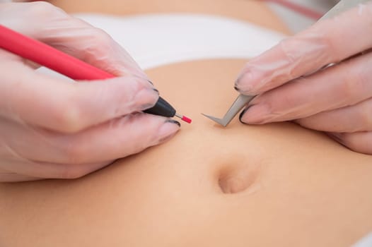 Woman on electro epilation on her tummy. Permanent hardware removal of unwanted abdominal hair