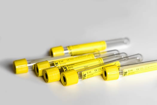 Empty tubes for blood or urine tests. Medical concept.