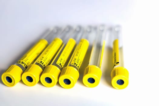 Empty tubes for blood or urine tests. Medical concept.