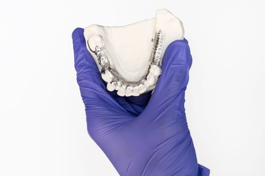 Isolated Metal Frame Lower Partial Denture with Die Stone, Plaster Cast Molds Of Lower Jaws in Gloved Human Hand on White Background, Cobalt Chrome Dental Plate, 3D Printed Bridge. Horizontal Plane