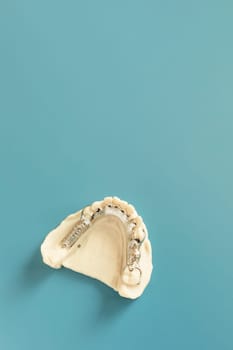 Mockup Metal Frame Lower Partial Denture, Plate On Die Stone, Plaster Cast Mold Of Lower Jaws, Cobalt Chrome Dental Plate, Mockup 3D Printed Bridge On Blue Background. Copy Space. Vertical Flatly.