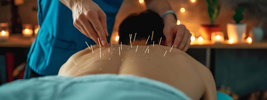 Acupuncture in a spa salon. Selective focus. People.