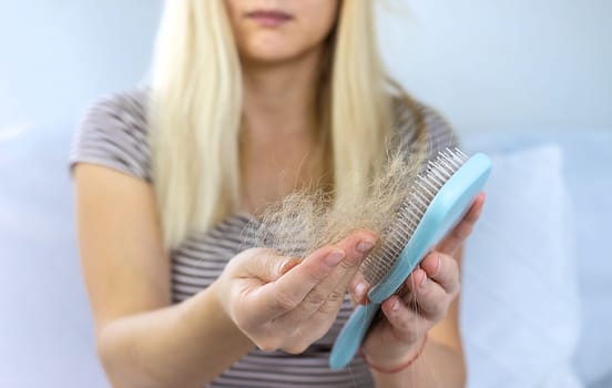 The woman hair is falling out. Selective focus. People.