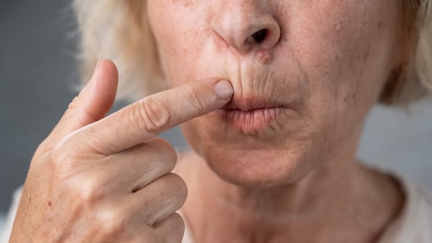 Unhappy elderly woman pointing at wrinkles around her lips