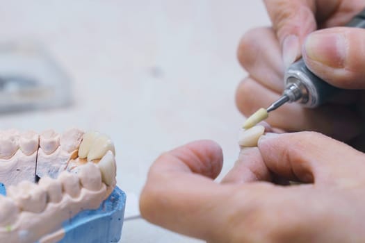 A dentist is making a denture. Close-up.