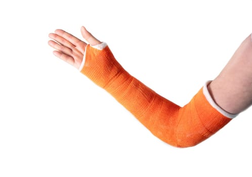 hand in an orange fiberglass cast after a fracture of the wrist bones for fixation on a white background, modern methods of treatment, high quality photo