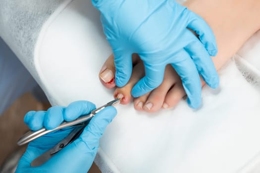 Professional medical pedicure using special nail instruments in the clinic.