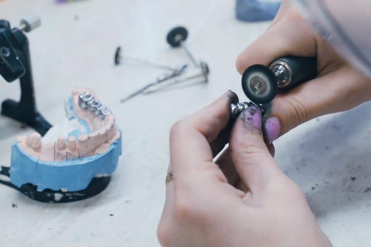 A dental technician works with crowns in a dental laboratory. The dentist manually mills dental crowns.