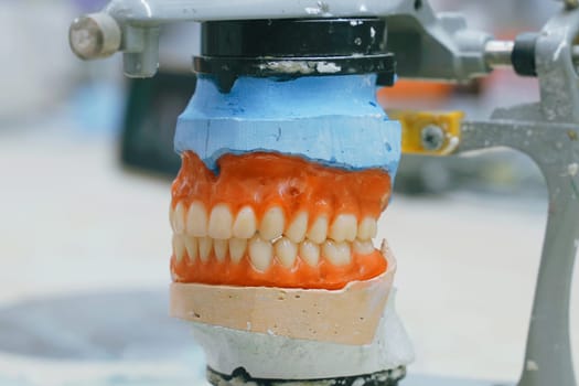 A detailed view of a tooth model on a table, showcasing the process of a dental technician making dentures, including soldering, melting, and forming techniques.