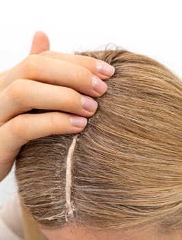 Closeup Middle Age Woman Applies Scalp Peeling, Scrub on Head Skin, Hair. Dandruff. Caucasian Female Holds Tube with Purifying and Soothing Cosmetics Product. Vertical. Template Haircare.