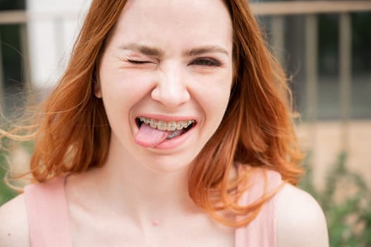 Young woman with braces on her teeth smiles and shows her tongue outdoors