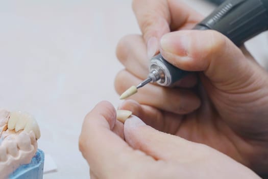 A dental technician is cutting a tooth using scissors for prosthesis manufacturing in this close-up video.