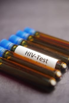 HIV blood test tube on black color background ,