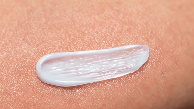 White Translucent Cream Smear on Skin Close-Up