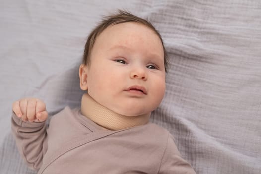 Top view of a newborn baby wearing an orthopedic collar