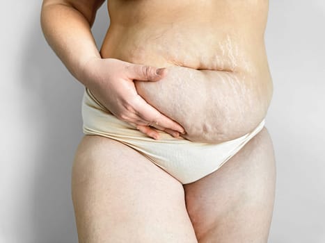 Postpartum womans midsection showing stretch marks, body positivity and real post pregnancy changes concept. High quality photo