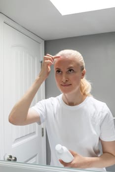 Caucasian Female Applies Moisturizer, Cream on Sunburn Skin On Scalp, Forehead Under Hair in Bathroom. White Woman Suffers From Face Sun Burn, Holding White Tube, Bottle of Remedy. UV Danger Vertical
