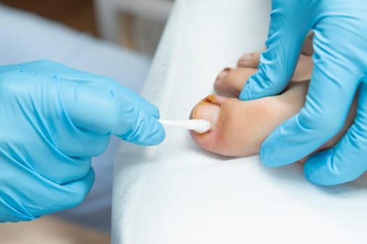 Close up a womans feet following podiatric care in the clinic