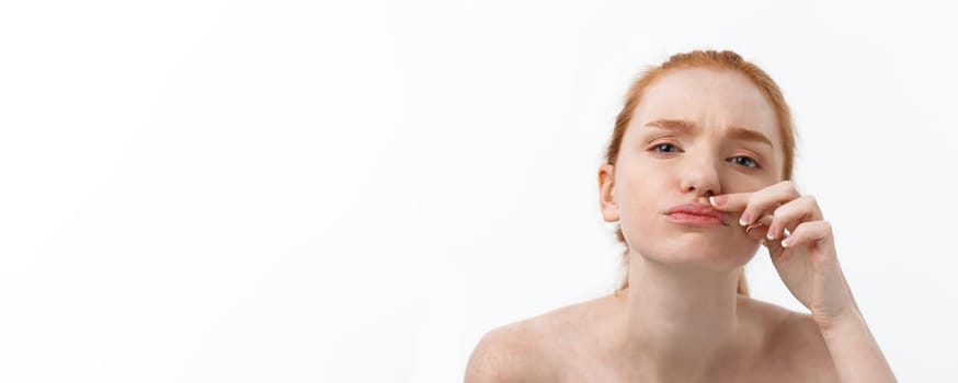 Young caucsian woman squeezes acne on the face of beauty.