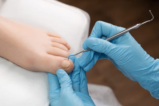 Podiatrist administering treatment for a fungal infection on a womans toenail.