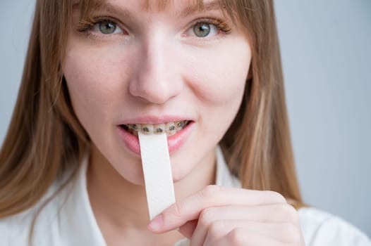 Young woman with metal braces on her teeth is chewing gum. The girl is eating gummy candy.