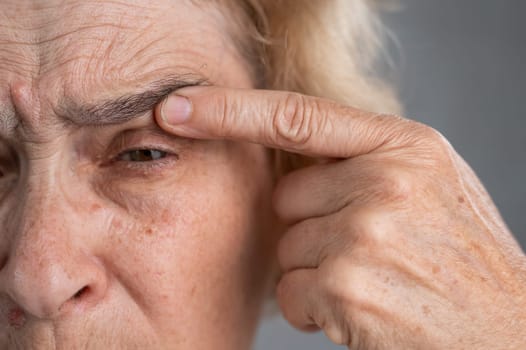 Close-up portrait of an old woman pointing at a wrinkle on her upper eyelid