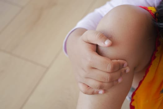 a little girl suffering knee joint pain,