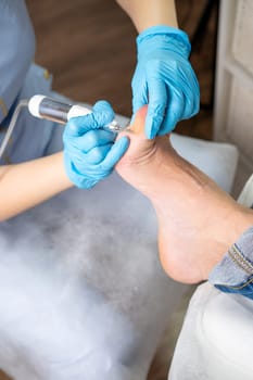 Close up callus removal from a woman's foot is performed by a podiatrist using an electric drill