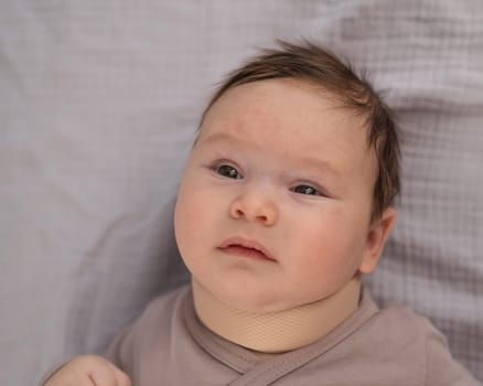 Top view of a newborn baby wearing an orthopedic collar