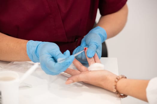 Doctor takes blood sample from a patient's finger using a capillary tube.