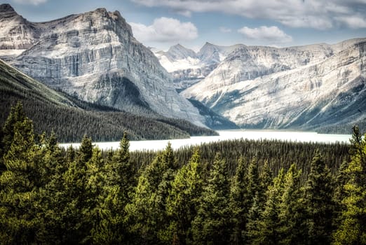 Spectacular Banff Hector Lake View from Ice Fields Parkway