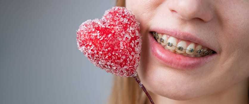 Cute woman with braces on her teeth holds a candy in the form of a heart on white background. Widescreen