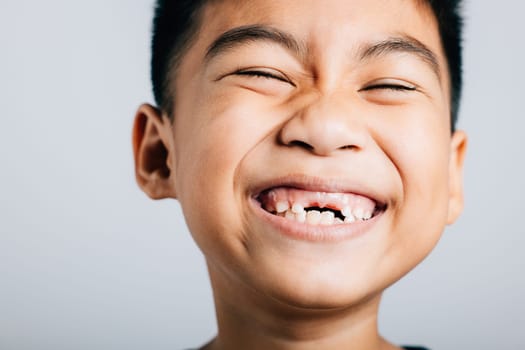 Boy without upper tooth smiles wide showing the gap. Child isolated portrait on white. Dental care tooth loss joyful growth development. Children show teeth new gap, dentist problems