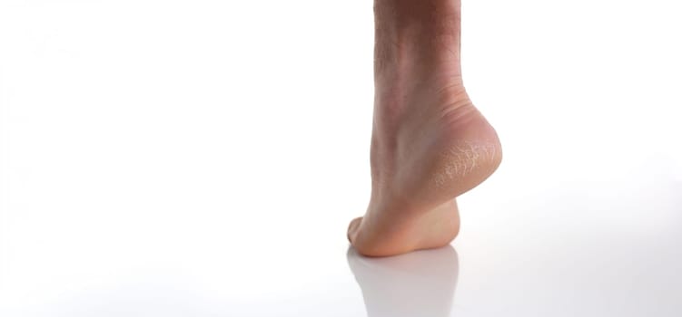 Close-up of heel of foot with bad skin, covered with cracks, use medical treatment, moisturizing cream or peeling. Unhealthy, dermatology problem concept
