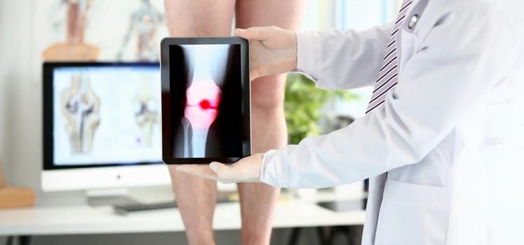 Male physician hands holding tablet computer showing xray shot with paintful area closeup