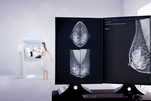 Mammography device  for screening breast cancer 3D woman model .3D rendering .