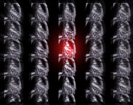 MRI heart or Cardiac MRI ( magnetic resonance imaging ) of heart for diagnosis heart disease.