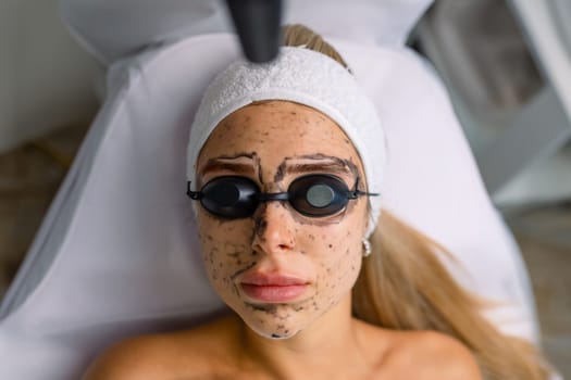 Close-up of cosmetologist's hand making hardware carbon peeling by young pretty customer woman in safety glasses headdress lying on couch in beauty salon. Facial cleaning concept. Cosmetology Services.