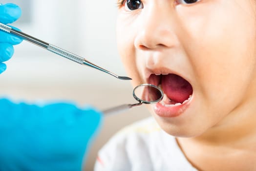 Dental kid health examination. Asian dentist making examination procedure for cute little girl open mouth, Doctor examines oral cavity of little child uses mouth mirror to checking teeth cavity