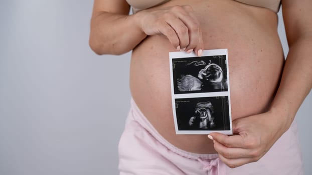 A pregnant woman holds a photo from an ultrasound screening against the background of a bare belly