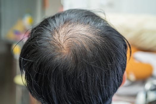 Bald in the middle head and begin no loss hair glabrous of mature Asian business smart active office man.