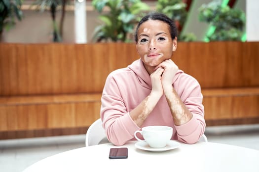 Black african american woman with vitiligo pigmentation skin problem indoor dressed pink hoodie sitting table