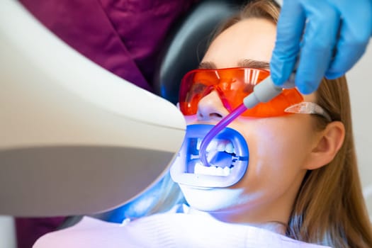 Suction of saliva from the oral cavity during the teeth whitening procedure for young woman
