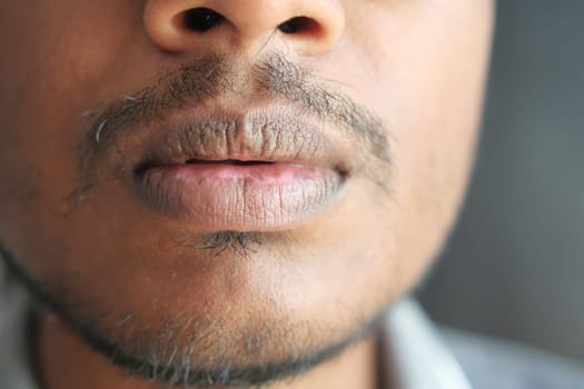 Close up of a young men hand dry lips .