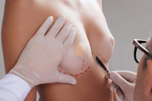 plastic surgeon holding scalpel near woman's breast close-up on white background . Breast augmentation concept