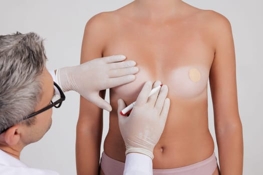 plastic surgeon wearing gloves making marks on breasts before surgery, concept of increasing size and changing shape of breasts